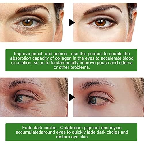 Fivewan Aloe Vera Under Eye Patches - 60 Pcs Eye Mask Pure Gold Anti-Aging Collagen Hyaluronic Acid Under Eye Mask for Removing Dark Circles