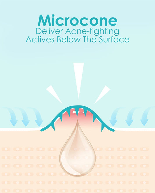 Microdart Acne Patch (9 Patches) - Hyaluronic Acid & Salicylic Acid Hydrocolloid Pimple Patch for Deep, Early and Hidden Blemishes (9 Count (Pack of 1))