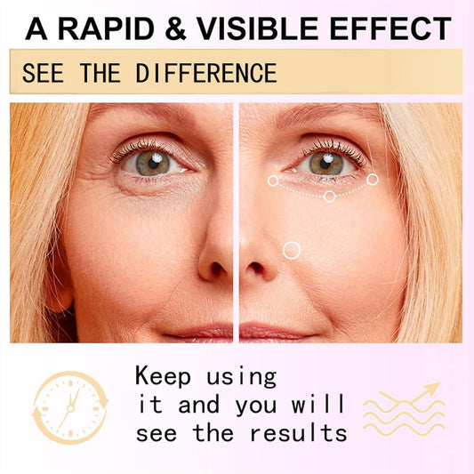 New Snail Peptide Eye Cream for Fine Lines, Dark Circles and Puffiness, With 73% Snail Mucin Filtrate & 2% Nicotinamide, Moisturizing, Hydrating, Firming, Brightening, 360ยฐ Massage Ball; YS-WN