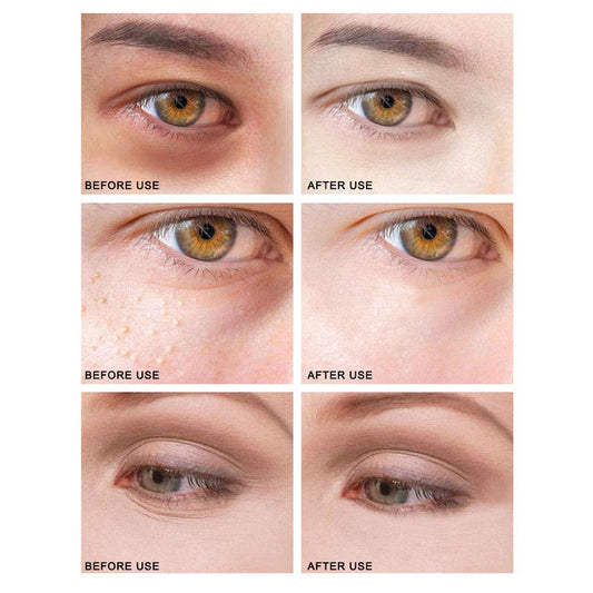 Golden Eye Cream Moisturizing Eye Serum Remove Dark Circles Fine Lines Eye Care Against Puffiness Eye Bags