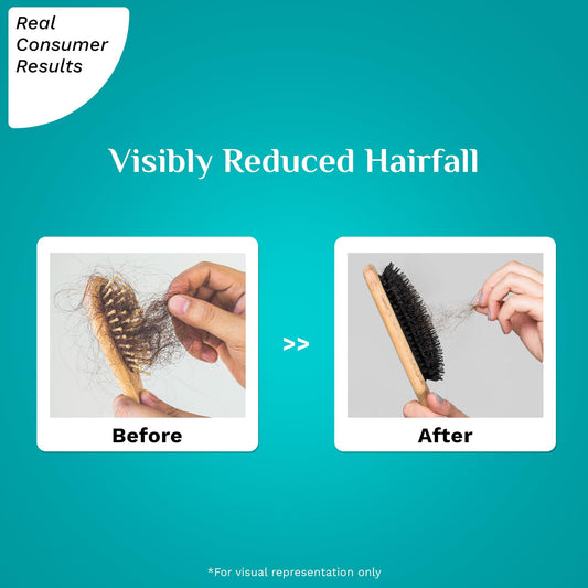 Rosemary Hair Serum for Hair Fall – Pilgrim RootActive Anti-Hairfall Serum with Caffeine, Biotin, Capilia Longa & Saw Palmetto | Reduces Hair Loss | For Men & Women | 1.01 Fl Oz (30ml)