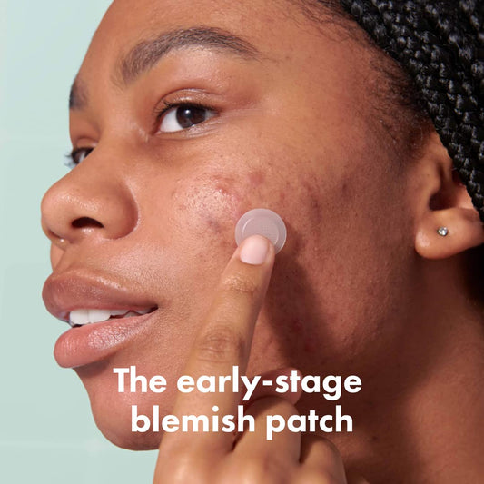 Mighty Patch Micropoint Large Hydrocolloid Pimple Patches for Face Blemishes from Hero Cosmetics, Acne Stickers for Early Stage Zits & Hidden Pimples, 395 Proprietary Micropoints, 8 Count