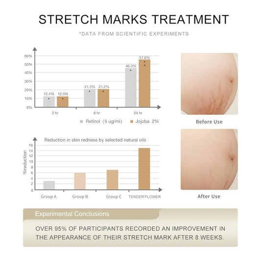 Stretch Mark Oil(110ml), body oil for Pregnancy,belly oil, belly abdominal Serum Skin Care,Moisturizing Dry Skin, Tender & Softening,True Belly Serum 3.7OZ