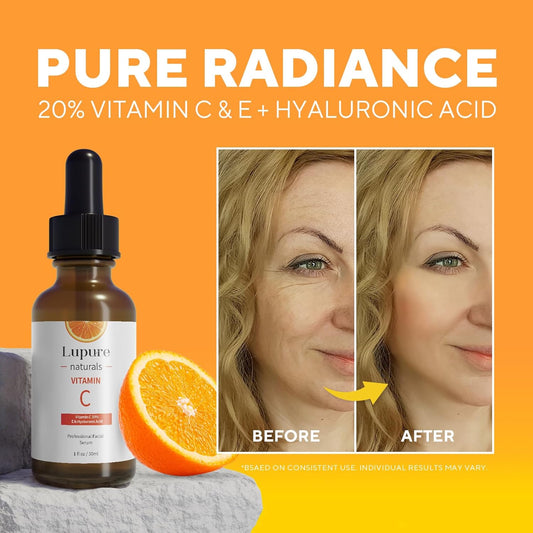Professional Vitamin C Face Serum 20%, Anti Aging Facial Super Vit C Serum with Ascorbic Acid Hyaluronic Acid & Vitamin E for Dark Spots, Skin Care, Christmas Gift & Stocking | 1 Fl. Oz