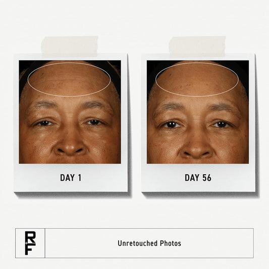 Rodan + Fields Redefine Daily Face Clay Cleanser (125 mL) | Advanced Skin Care | Exfoliating Face Wash & Face Mask for Sensitive Skin | Anti-Aging Face Cleanser for Women and Men