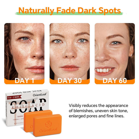Kojic Acid and Turmeric Soap for Dark Spots Remover, Brightening, Hyperpigmentation for Face, 4oz x 2 BARS