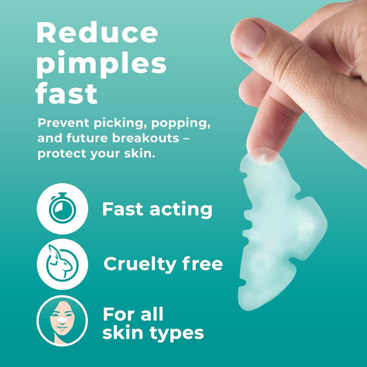 Pimple Patches for Nose (12 Pack), Cover Nose Pimples Overnight - Hydrocolloid Acne Patches - Pimple Patch Hydrocolloid Patches & Pimple Stickers, Nose Strip, Zit Patches