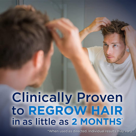 Amazon Basic Care Minoxidil Topical Aerosol, 5% Foam, Hair Regrowth Treatment for Men, 6-month Supply, Unscented, 2.11 oz (Pack of 6)