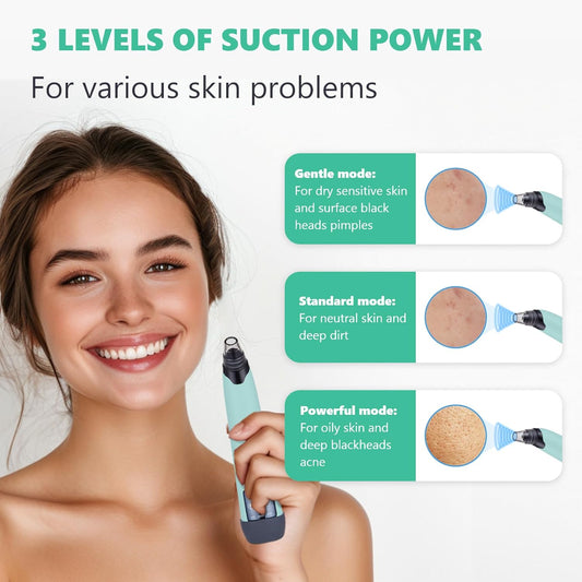 Blackhead Remover Vacuum - Black Head Remover for Face,Blackhead Extractor Tool with 3 Adjustable Suction Levels,4 Probes,USB Interface Type Pore Vacuum,Suitable for Women and Men (Green)