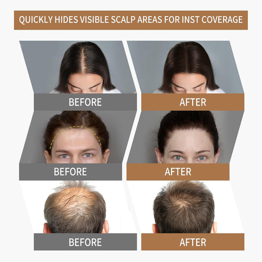 Sevich Hairline Powder 2.0,Instantly Conceals Hair Loss, Root Touch up Powder, Hair Shadow Toppers for Women & Men Thinning Gray Hair, Windproof & Sweatproof, 48H Makeup Lasting, Black