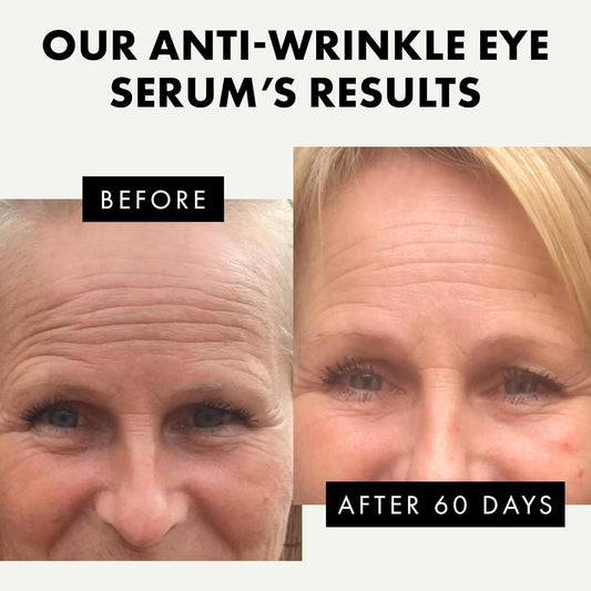 ๐ง๐ข๐ฃ ๐ฎ๐ฌ๐ฎ๐ฏ* Eye Serum - Under Eye Cream for Dark Circles and Puffiness - Anti Aging Eye Cream, Under Eye Brightener Eye Bags Eye Treatment, Caffeine Eye Cream Puffy Eyes Treatment Dark Circle