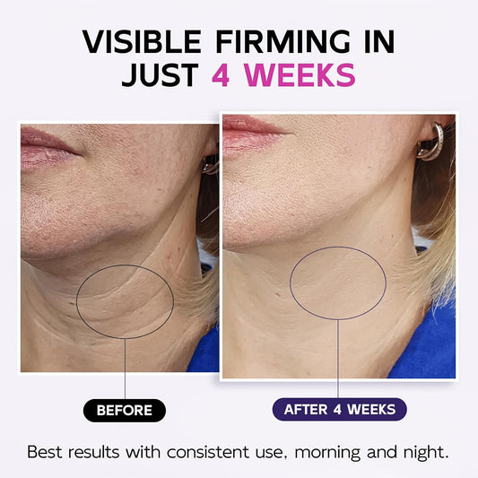 Firming Neck & Décolleté Cream with Retinol, AH-8 Hexapeptide, Collagen & Squalane – Instant Face Lift Cream for Wrinkles, Tightening & Crepey Skin – Neck Firming cream with Massage Roller – 4.3 fl oz
