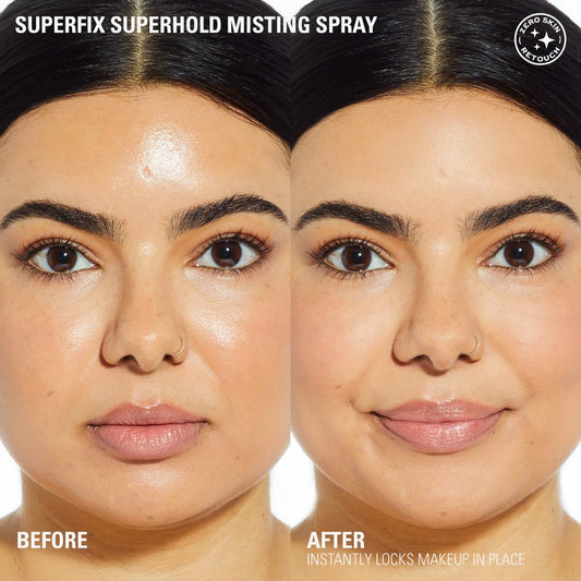 Revolution Beauty London, Superfix Misting Makeup Setting Spray, Ultra-Matte & Shine-Free Finish, Long-Lasting & Lightweight Mist, Infused with Vitamin E, 5.07 fl oz