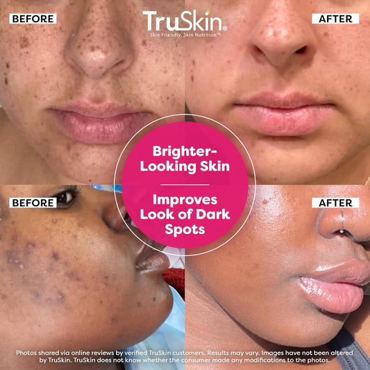 TruSkin Vitamin C Super Serum - Niacinamide, Retinol, Hyaluronic & Salicylic Acid - All-in-One Anti Aging Serum for Face – Improve Appearance of Dark Spots, Firmness for Brighter Looking Skin, 1 Fl Oz