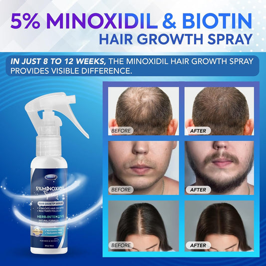 5% Minoxidil Hair Regrowth Spray : Minoxidil for Women Hair Growth Treatment, Minoxidil 5 percent for Men Beard Growth - 60ml