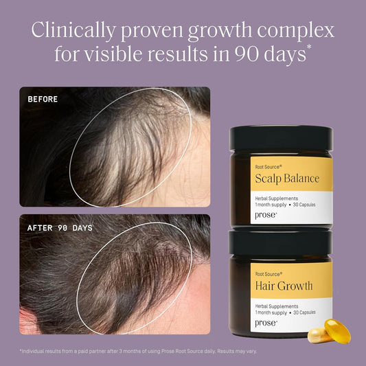 Prose Scalp Balance & Hair Growth Supplements, Scalp Relief, Clinically Proven Growth Complex for Visibly Fuller Hair in 90 Days, Vegan, Biotin, No Hormone Disruptors, Gluten Free, 1 Month Supply