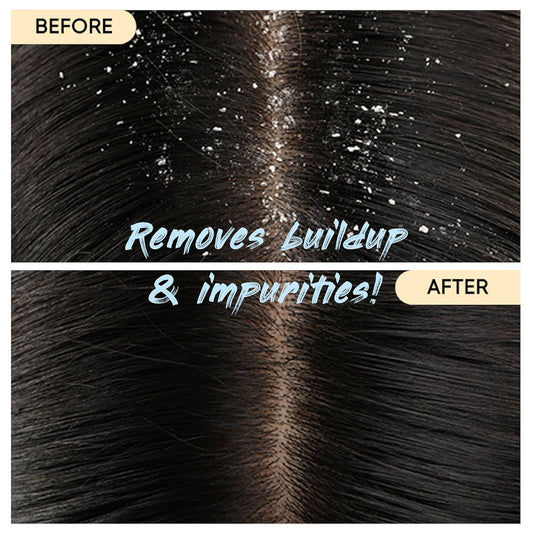 Charcoal Shampoo Bar 2.0 - Hydrating & Moisturizing Natural Hair Soap Bar Shampoo for Excess Oil Build-Up & Scalp Nourishment - Bathing Soap Solid Shampoo for All Hair Types (120g, 4.23oz)