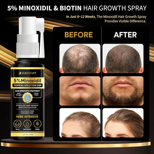 Minoxidil for Women 5 Percent: 5% Minoxidil for Men Beard Growth Spray Infused with Biotin - Extra Strength Hair Regrowth Treatment for Stronger and Longer Hair 2 Fl Oz