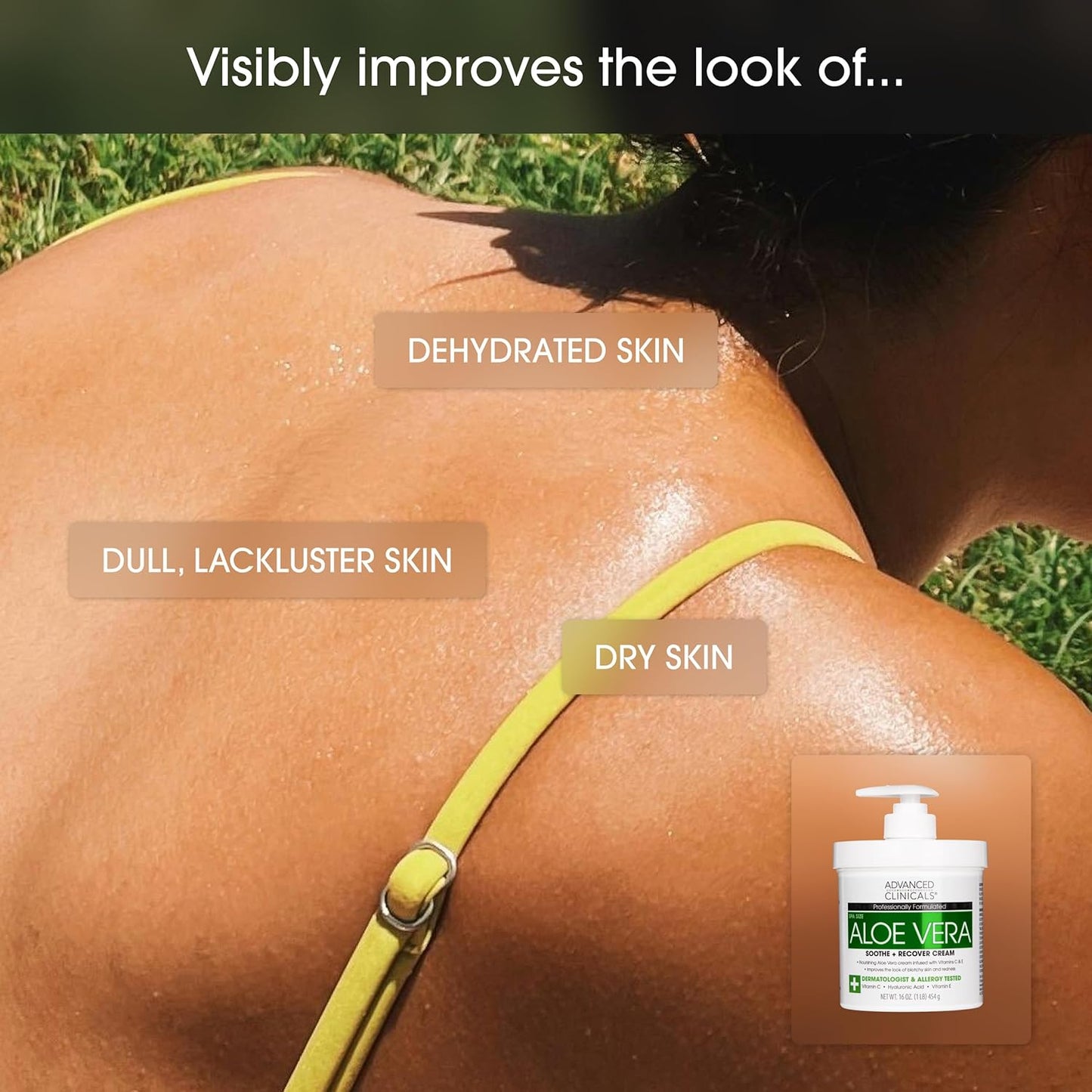 Advanced Clinicals Aloe Vera Lotion Skin Care Relief Cream | Vitamin E Infused Hyaluronic Acid Moisturizer & Vitamin C Body Lotion For Women & Men Helps Improve Look Of Extremely Dry Skin, 16 Ounce