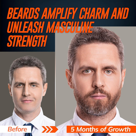 5% Minoxidil Beard Growth Serum for Men: Hair Regrowth Spray with Biotin & Rice Water - Extra Strength Beard Oil for Faster Thicker and Fuller Beard Growth - 2.03 Fl Oz