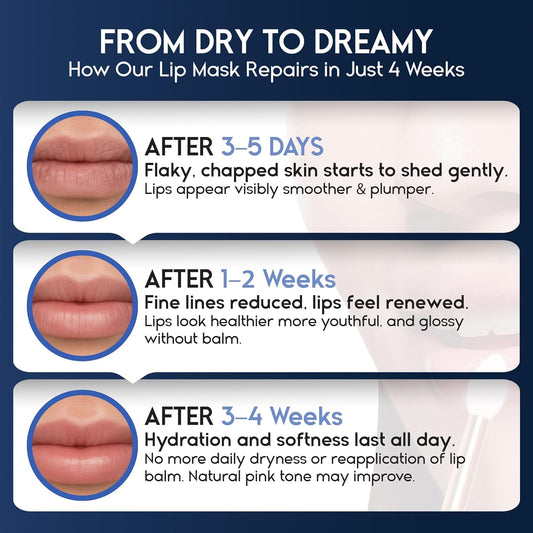 Lip Mask Overnight with Hyaluronic Acid & Collagen, Lip Sleeping Mask for Dry Cracked Lips, Moisturizing, Hydrating, Exfoliating Night Treatment for Lip Care (Strawberry) (0.7, Berry)