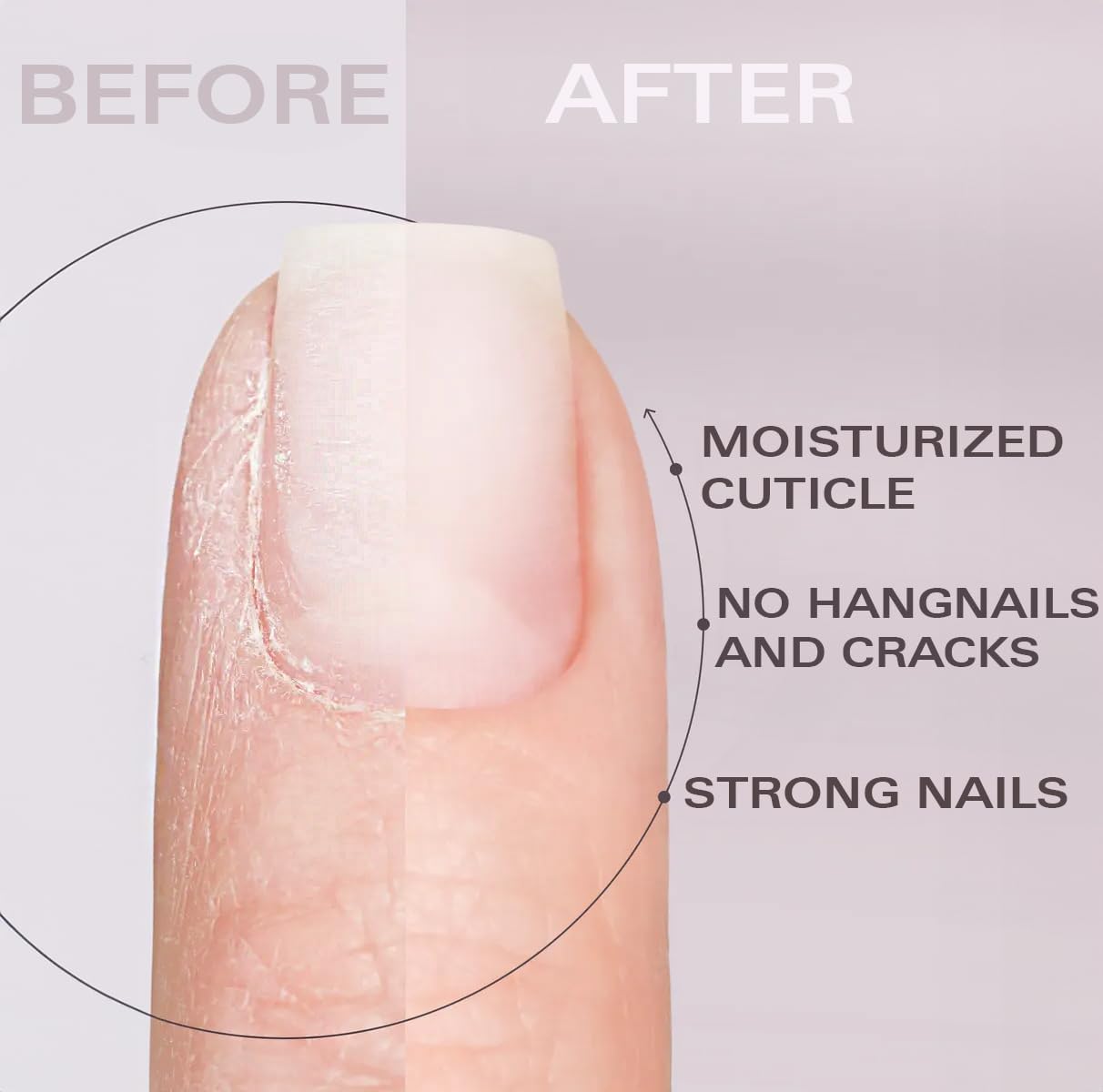 Nail Oil Cuticle Pen - Watermelon - Nail Strengthener & Growth Serum with Vitamin A, D, E, B5, Grapeseed & Natural Oils - Repair for Brittle, Peeling, Thin Nails - Twist Brush Pen