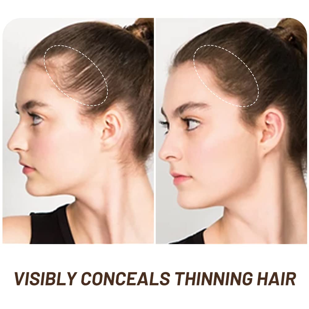 Root Touch Up Hair Powder, Instantly Gray Hair Root Cover Up Hairline Powder, Hair Concealer For Women and Men (A-Medium Brown, 2PC)