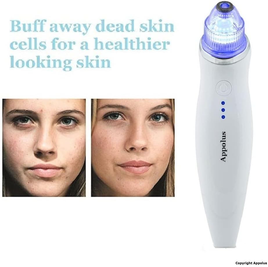 Microdermabrasion Machine - Appolus Premium Diamond Microdermabrasion Device Tool - 2 Diamond Tips - 5 Heads - Blackhead Blemishes Remover - Pores Fine Lines Minimizer