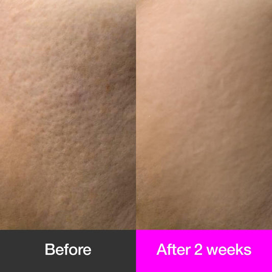 Black Cherry Pore Tightening Cream Luftig, Pore Minimizer, Black Cherry Extract, AHA, Hydrolyzed Collagen, Korean Skincare, All Skin Types, 3.3 fl.oz / 100ml