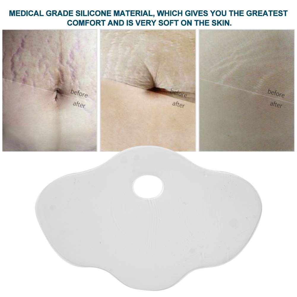 Scar Removal Sheet, Reusable Silicone Anti-Wrinkle Belly Stomach Pads Stickers Stretch Marks Removal Skin Care, Health and Beauty Supplies