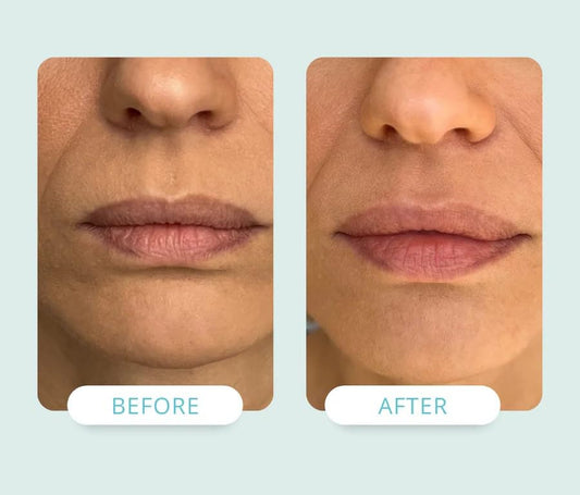 NADIA Lip Renewal Cream with NAD+ 10 ml / 0.34 fl oz (Made in USA)