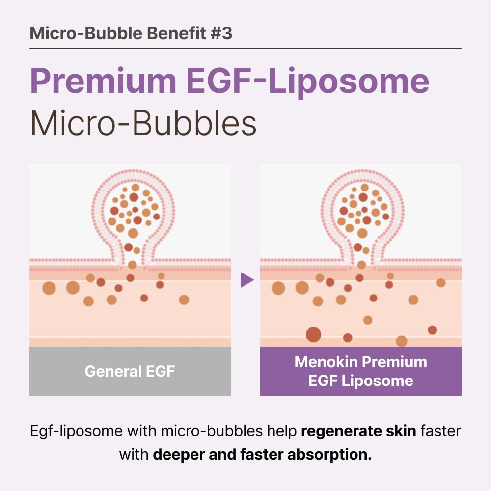 MENOKIN 30 Seconds Quick Bubble Mask [REPAIR] - [EGF Liposome] in Micro-bubbles for Skin Restoration, Hypoallergenic Bubble Capsule for Deep Repair, Korean Skin Care Essential, 70 Uses, fl.oz