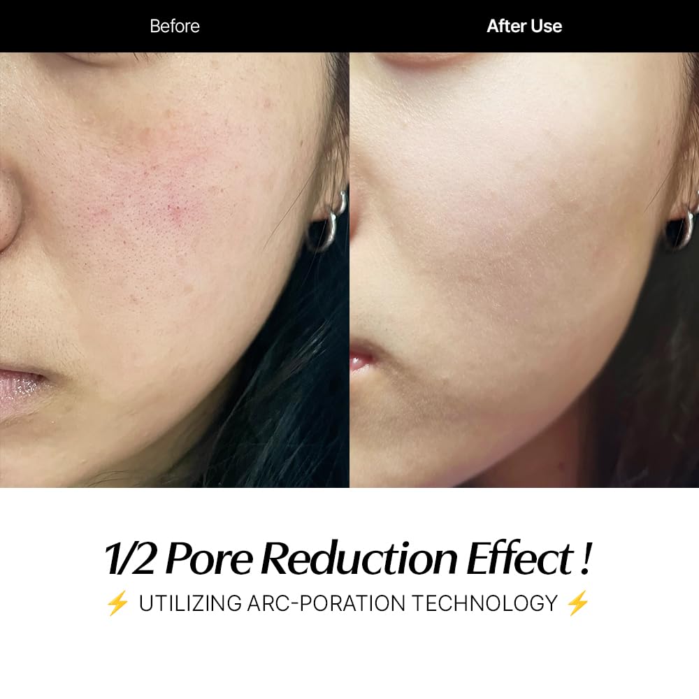 CELORABY Potension Penta-Shot Glass Skin Glow Booster Korean Skin Care Device 5-in-1 Total Care for Enhanced Absorption, Intensive Pore Care, Needle Free, Professional Skincare Comfortably at Home