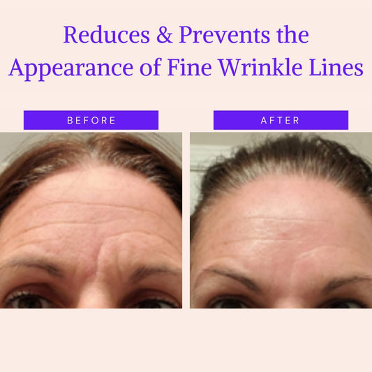BLUMBODY Face & Forehead Wrinkle Patches - Anti Wrinkle Facial Patches to Smooth Eye, Mouth, Forehead Wrinkles - Non-Silicone Face Tape for Fine Wrinkles between Eyes & Face - Patches (30 day supply)