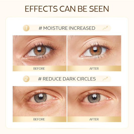 50-Pack Snail Eye Patches with Caffeine & Hyaluronic Acid - Moisturizing Golden Eye Masks for Dark Circles,Puffy Eyes, and Under-Eye Bags - Revitalize Your Skin Care Routine