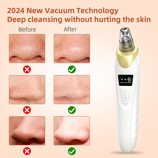 2025 Pore Vacuum, USB Rechargeable Blackhead Remover Vacuum,3 Levels Adjustable Pore Vacuum Blackhead Remover, with 5 Suction Power,6 Probes,Face Vacuum Pore Cleanser for Women & Men-Gold