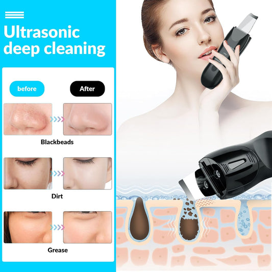 Facial Skin Cleanser with Mister, Upgraded Sprayer, Blackhead Extractor for Deep Cleansing and Moisturizing Spray