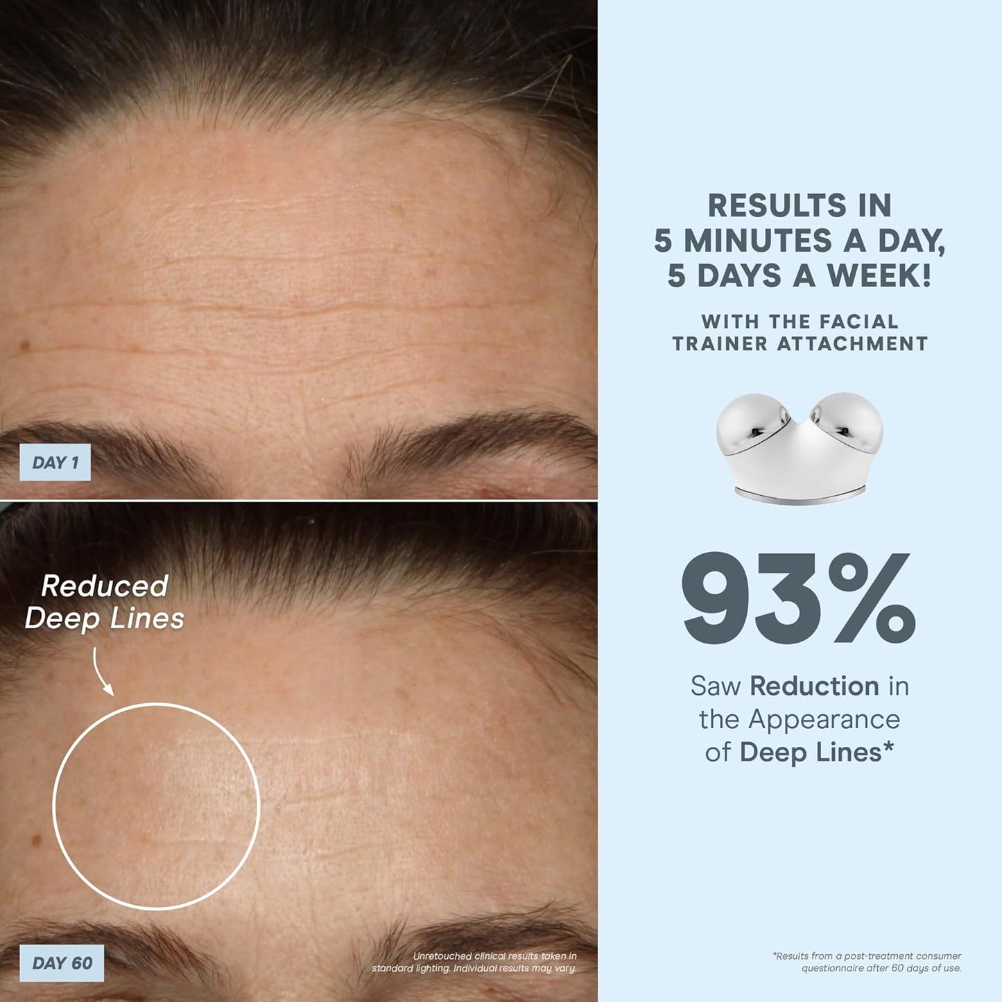 NuFACE TRINITY+ Microcurrent Facial Device Kit - Limited Edition FDA Cleared Face Massager Device + Microcurrent Gel Activator, Cleansing Wipes & Brush - Velvet Rose