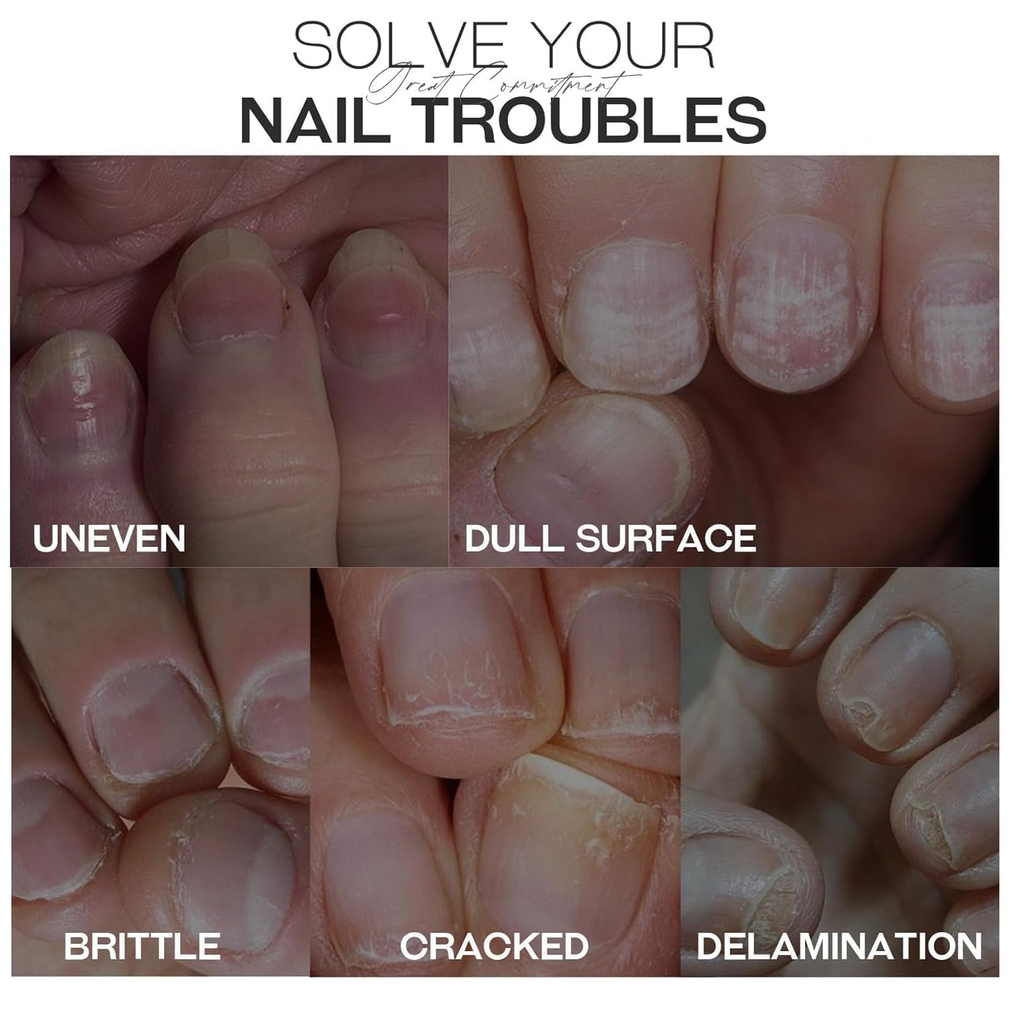 Base Top Coat Nail Polish: 3 in 1 Clear Quick Dry Nail Polish Nail Strengthener and Growth Hardener for Nail Treatment Repair Damaged Nail Care 0.5 fl oz