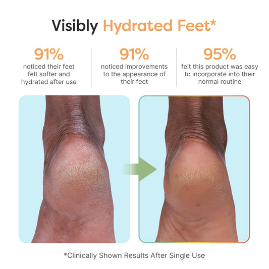 ZenToes Moisturizing Foot Mask for Dry Cracked Feet | Shea Butter, Jojoba Oil & Squalane Infused Hydrating Sheet Masks | Spa Experience At Home | Mess Free Design | Vanilla Citrus Scented, 1 Pair