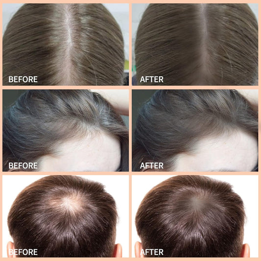 Boobeen Hair Shadow Powder Kit, Root Touch Up Powder Cover Hair Color, Temporary Concealer Powder with Brush for Gray Hair Root