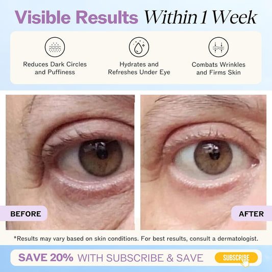 LilyAna Naturals Eye Cream for Dark Circles and Puffiness, Under Eye Cream for Wrinkles and Bags, Anti Aging Cream helps Improve Dryness; for Sensitive Skin 0.5 oz