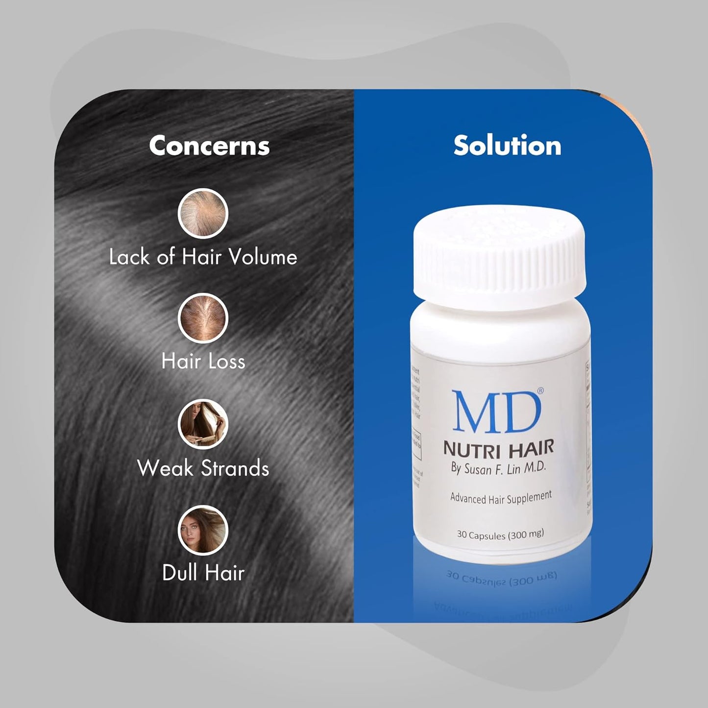 MD Nutri Hair Growth Supplement con biotina (30 cápsulas) | Previene la caída del cabello, minimiza la caída del cabello, el adelgazamiento, la rotura y promueve el cabello más largo y grueso | Formul
