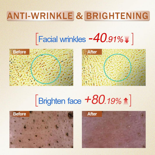 Vitamin C Serum for Face with Hyaluronic Acid, Boost Skin Collagen, Brightening, Antioxidant, Anti-Aging, Hydrate & Plump, Improve Appearance of Dark Spots, Tone, Fine Lines Facial Serum 30ml/1 fl oz