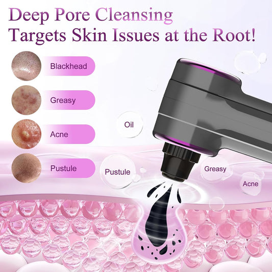 Blackhead Vacuum Removers with Heating, Pore Vacuum Blackhead Suction Remover, 3 Adjustable Suction Levels 9 Modes, Comedone Extractor Kit with 5 Suction Heads for Nose & Face Deep Pore Cleaning