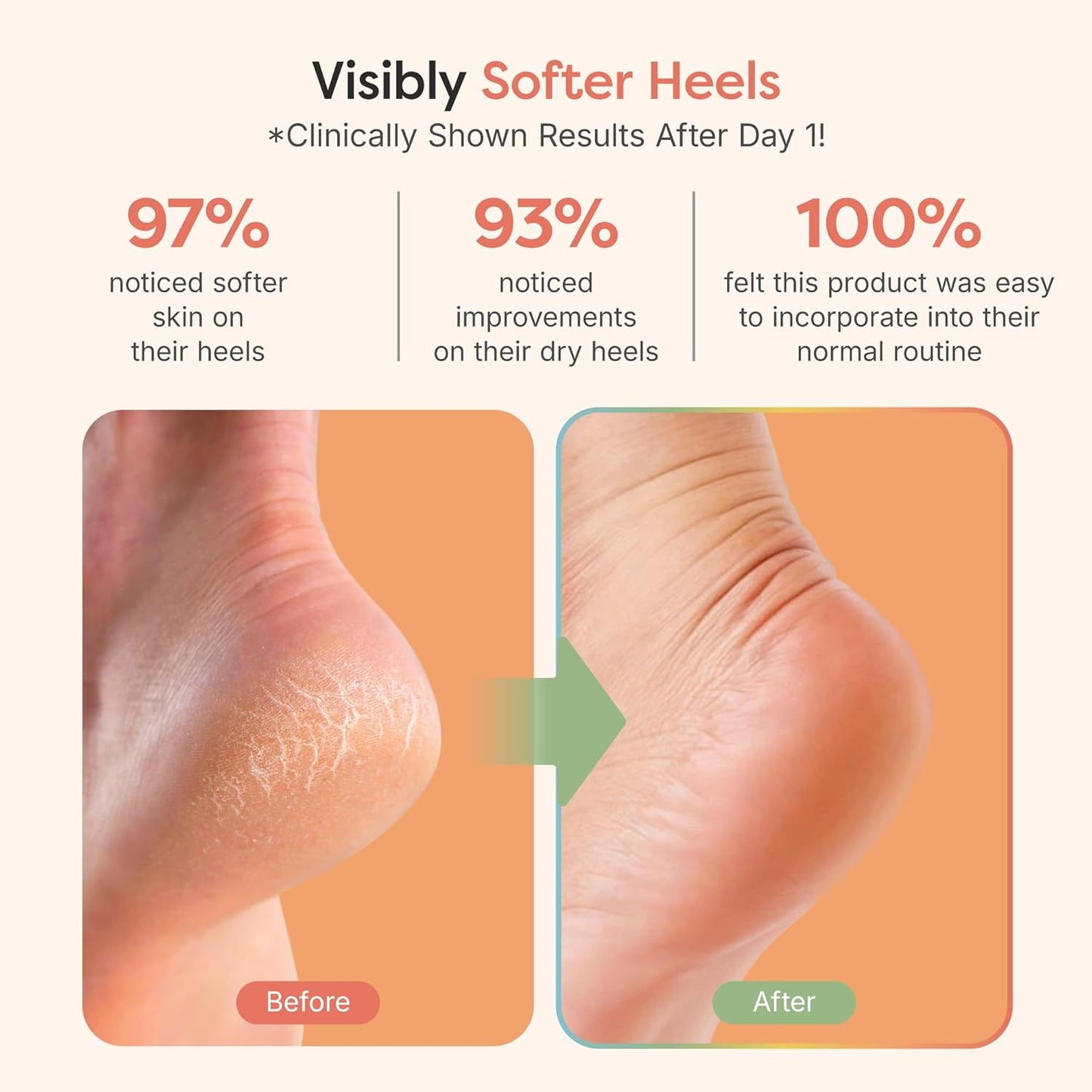 ZenToes Moisturizing Socks for Cracked Heel Treatment - Vitamin E, Olive Oil and Jojoba Oil Infused Heel Socks to Soften and Hydrate (Fuzzy Pink, Regular)