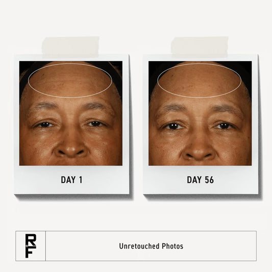 Rodan + Fields Redefine Regimen | Skincare Kit Includes Clay Cleanser, Toner, Triple Defense Cream, & Overnight Cream | Skin Care Gift Set for Women