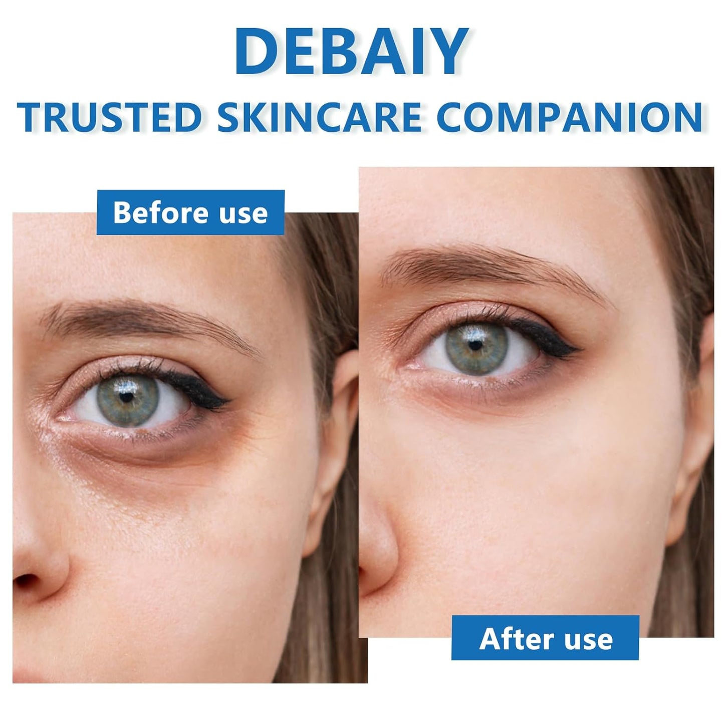 3 Pack Anti-Wrinkle Eye Cream with Caffeine & Peptides - Reduces Dark Circles & Puffiness, Improves Skin Texture (Each 0.529oz | 15g)