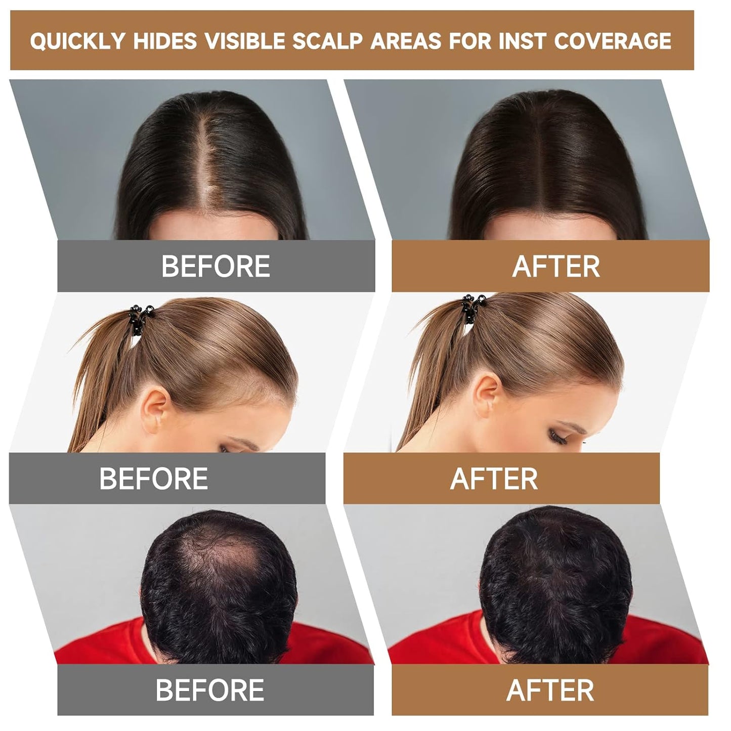 Root Touch Up Powder, Instantly Gray Hair Cover Up, Women Color Root Coverage Shadow Powder for Thinning Grey Hairline, Men Roots Concealer for Hair Loss Beard Line Eyebrow, Medium Brown