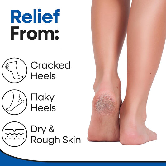 Moisturizing Socks for Women & Men | Aloe Vera Cracked Heel Treatment | Foot Callus Remover | Aloe Socks for Cracked Heels & Dry Feet | Lotion Infused Gel Heel Sleeves (Fits Most)